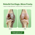 Before and after illustration of cartilage regeneration with text about cartilage support.
