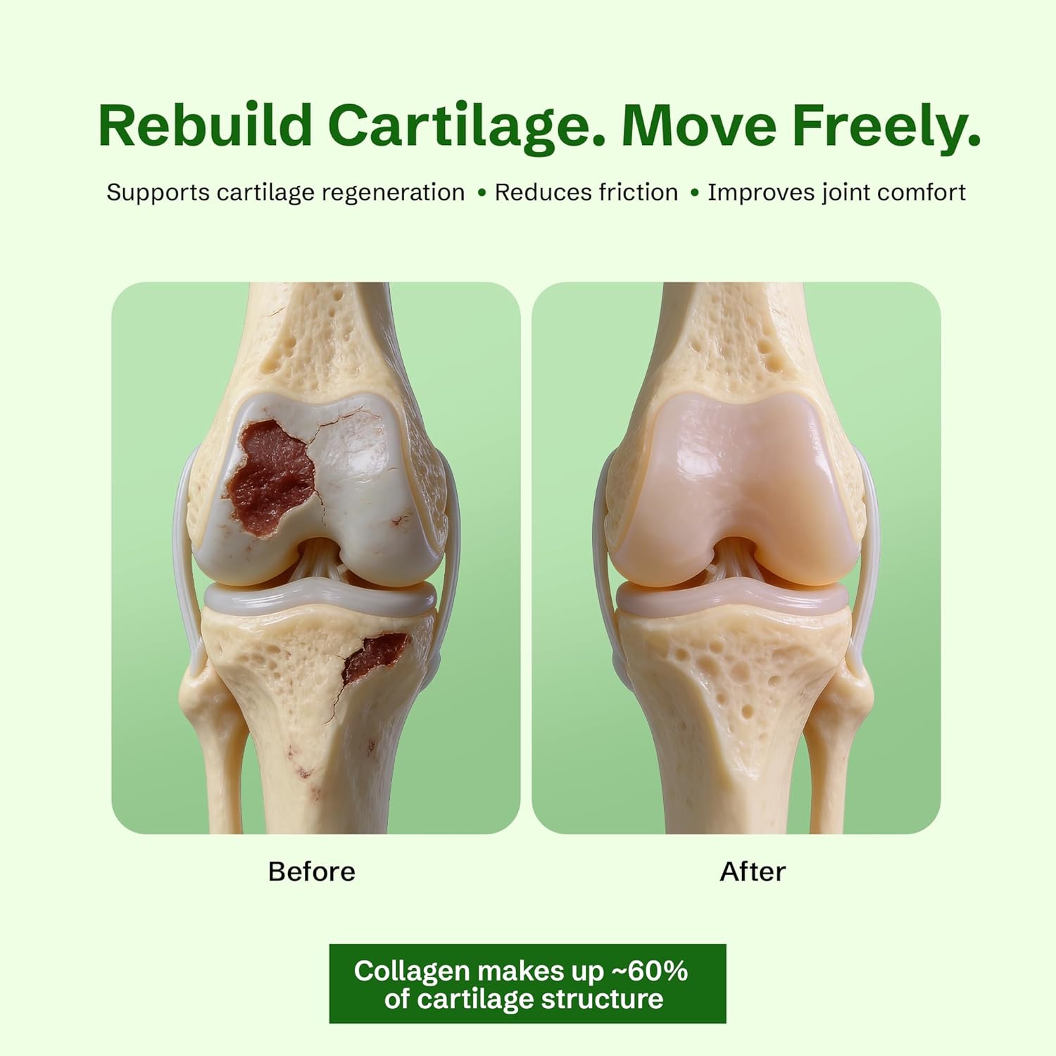 Before and after illustration of cartilage regeneration with text about cartilage support.