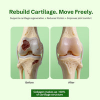 Cartilage structure explainer